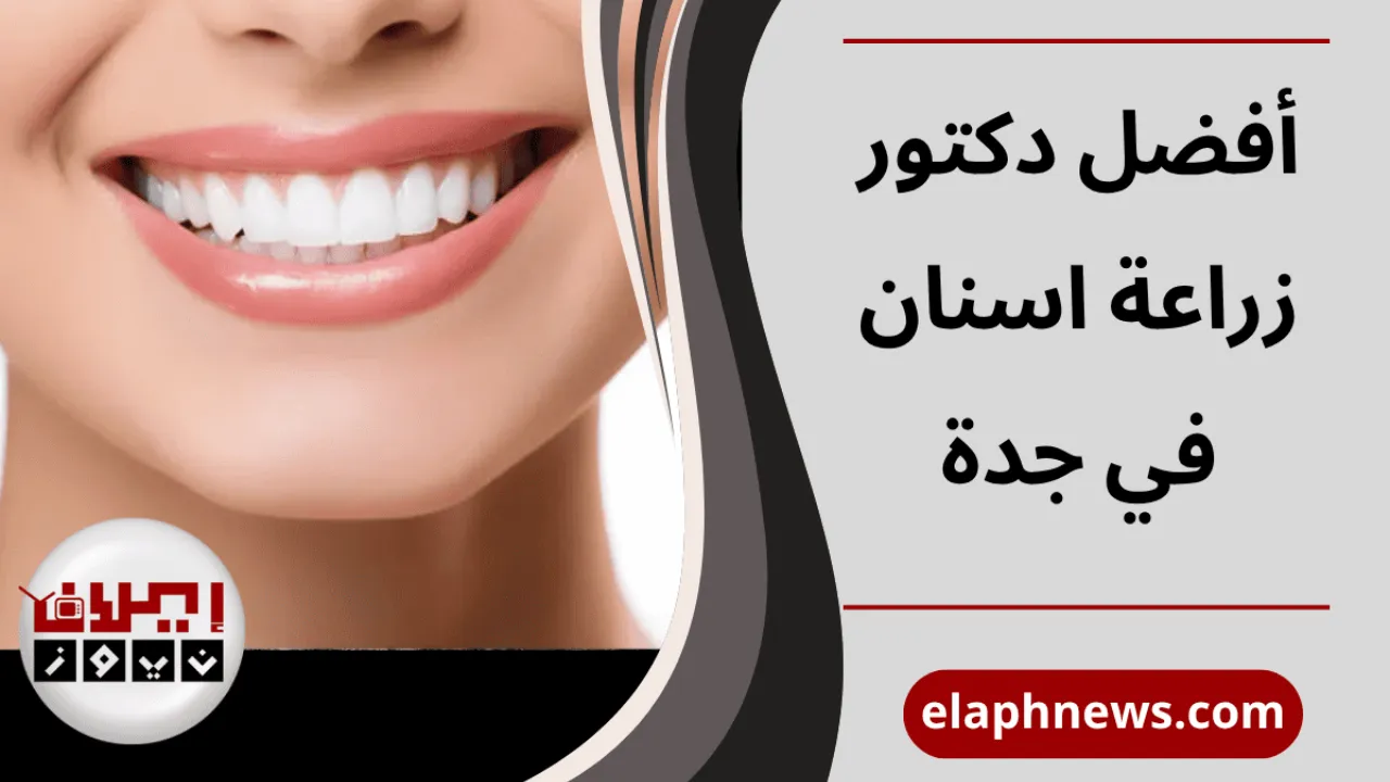 افضل دكتور زراعة اسنان في جدة