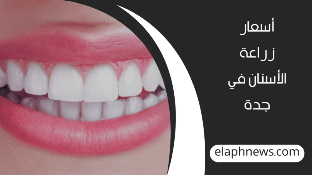 أفضل-دكتور-زراعة-اسنان-في-جدة-4-1-1280x720-1-1024x576 افضل دكتور زراعة اسنان في جدة